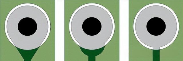 PCB teardrop típusok